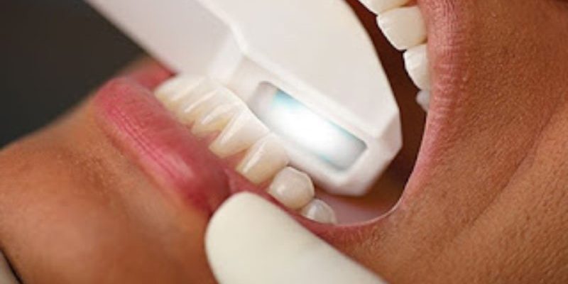 escaner-clinica-dental-barrutia