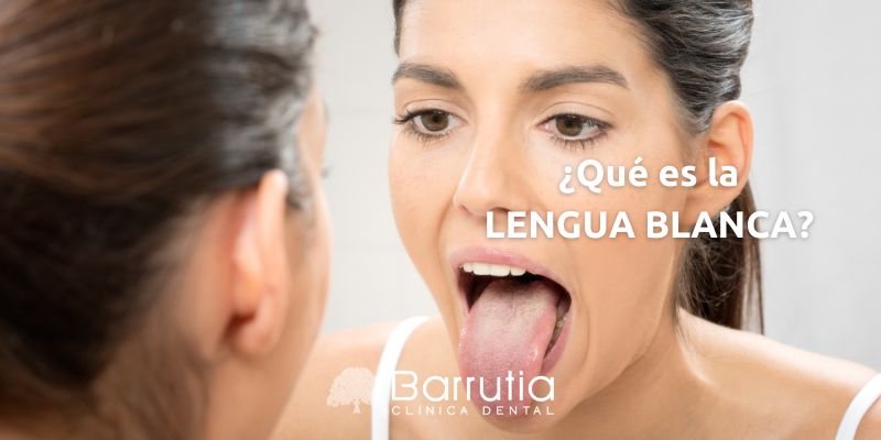 ¿Qué es la lengua blanca?