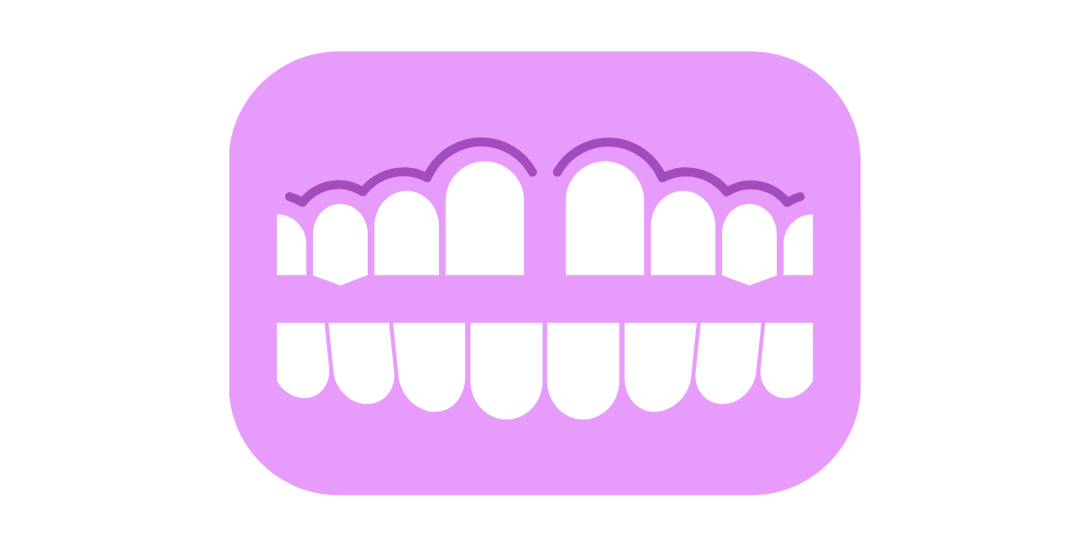 Diastema dental ortodoncia Getafe