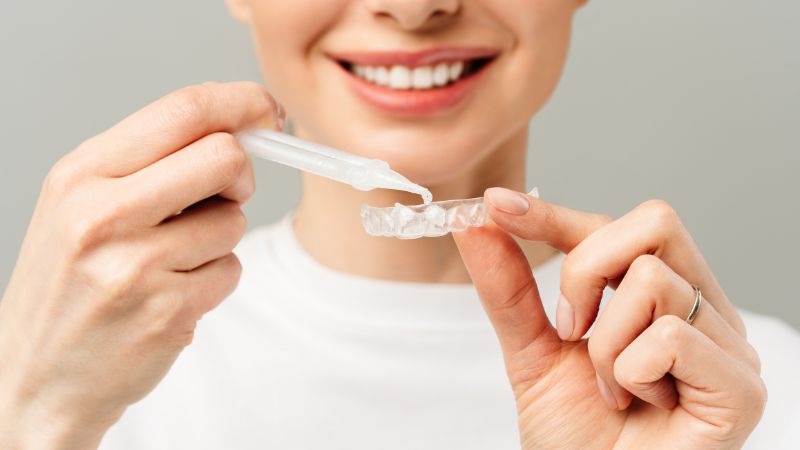 Blanqueamiento dental en casa Getafe Clínica Dental Barrutia