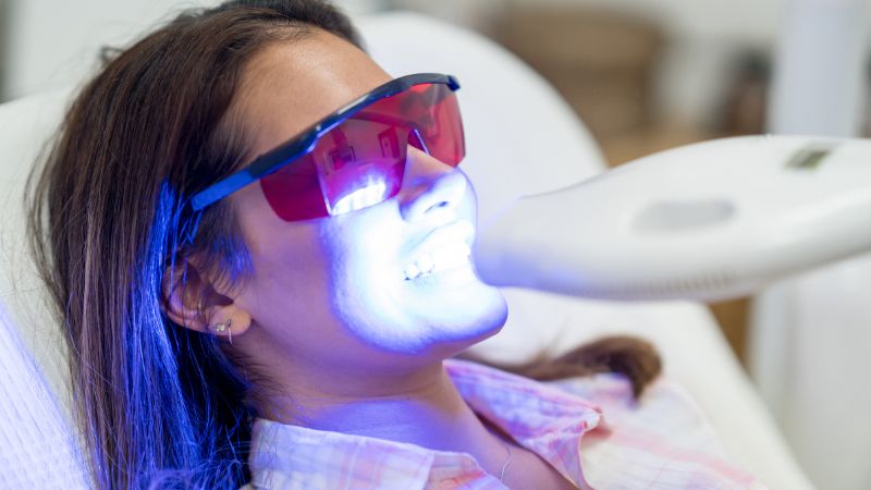 Blanqueamiento dental en clínica Getafe Clínica Dental Barrutia