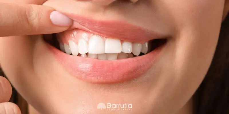 Estrés y encías: cómo el estrés afecta a la salud periodontal | Barrutia